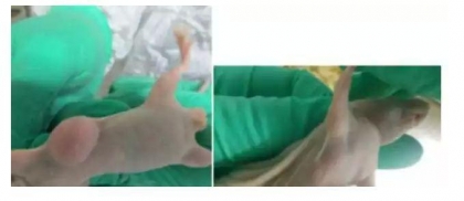 裸鼠成瘤實(shí)驗(yàn)