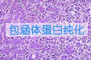包涵體蛋白純化和復性