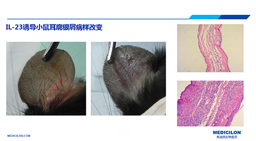 白介素IL-23誘導的小鼠耳廓銀屑病樣改變
