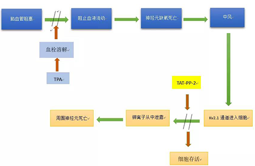 腦卒中形成機制 腦卒中形成機制