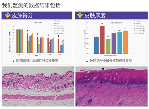 美迪西建立的特應性皮炎及濕疹模型監測數據結果