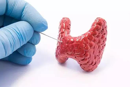 甲狀腺疾病，包括甲狀腺功能減退和甲狀腺功能亢進，自古以來就是反復被醫學研究人員研究的疾病