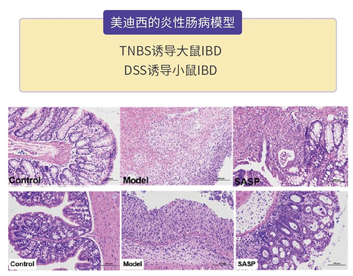 美迪西的炎性腸病模型.png 美迪西的炎性腸病模型.png